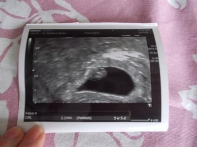Bild zu Herzchen blubbert :-) - Forum für Oktober - Mamis