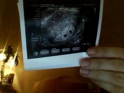 Bild zu Ergebnis erster US - soooooo glücklich :-) - Forum für Oktober - Mamis