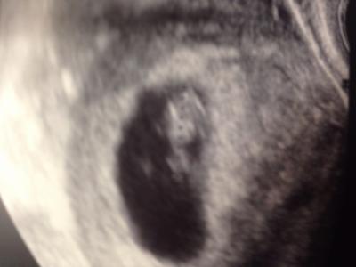 Bild zu Ein kleiner Gummibär < 3 - Forum für Oktober - Mamis