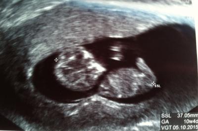 Bild zu 3,7cm Wunder... - Forum für Oktober - Mamis