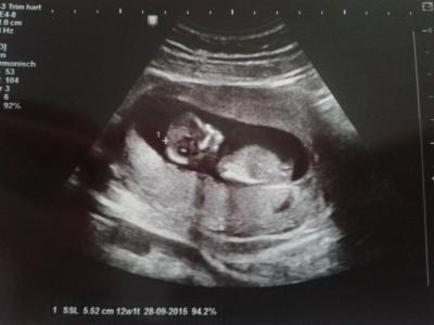 Bild zu Befördert! - Forum für Oktober - Mamis