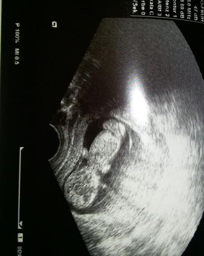 Bild zu FA - Termin erfolgreich :-* - Forum für Oktober - Mamis