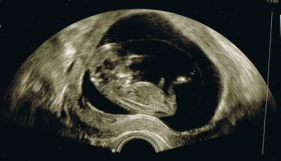 Bild zu Möchte mich zu euch Gesellen =) - Forum für Oktober - Mamis