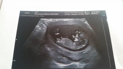 Bild zu zurück vom Doc und so stolz :) - Forum für Oktober - Mamis