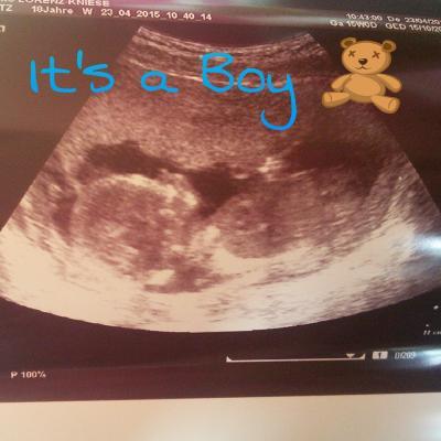 Bild zu der Zwerg hat sich gezeigt :-) - Forum für Oktober - Mamis