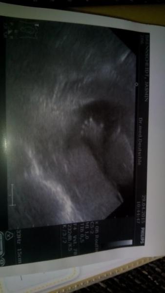 Bild zu Mein baby winkt - Forum für Oktober - Mamis