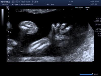 Bild zu War heute in der pränatal Praxis ;) - Forum für Oktober - Mamis