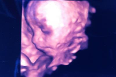 Bild zu Gestationsdiabetes - wer hat Erfahrung damit? + 3D-Bild - Forum für Oktober - Mamis
