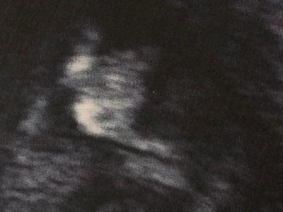 Bild zu Hatten auch wieder gyn Termin :) - Forum für Oktober - Mamis