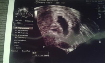Bild zu 1.FA Besuch geschafft :-) - Forum für Oktober - Mamis