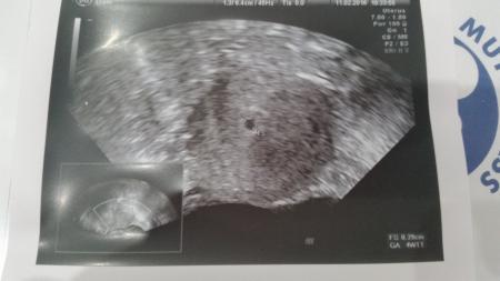 Bild zu Ultraschallbild :)))) - Forum für Oktober - Mamis