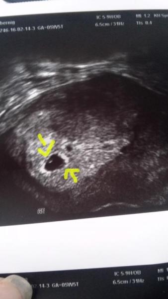 Bild zu Eventuell Twins :) - Forum für Oktober - Mamis