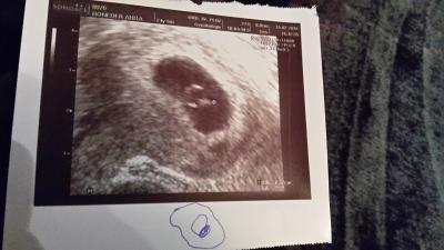 Bild zu 1. FA Termin Bericht - Forum für Oktober - Mamis