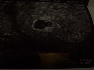 Bild zu US-Bild von heute?! - Forum für Oktober - Mamis