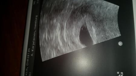 Bild zu darf ich vorstellen .... - Forum für Oktober - Mamis