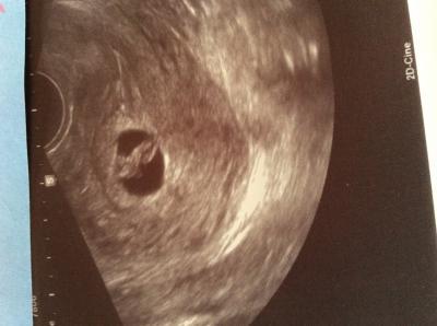 Bild zu Baby Tv ;-) - Forum für Oktober - Mamis