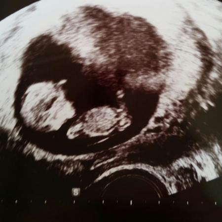 Bild zu von FÄ zurück - Forum für Oktober - Mamis