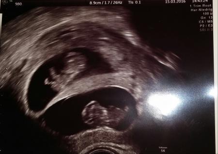 Bild zu Eure Ultraschallbilder:) - Forum für Oktober - Mamis