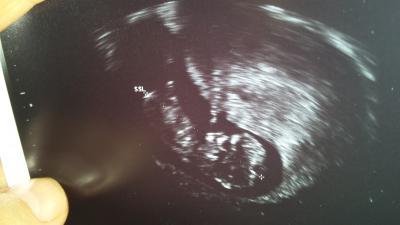 Bild zu bin zurück und total happy - Forum für Oktober - Mamis