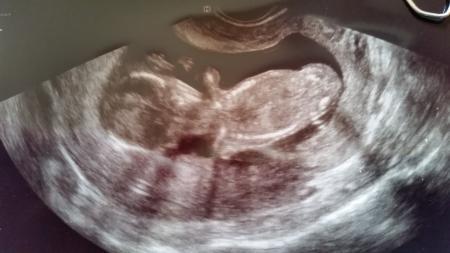 Bild zu plummmmbbbbssss - Forum für Oktober - Mamis