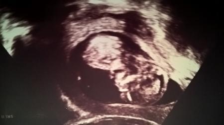 Bild zu Zurück vom FA dafür jetzt in der Kindernotaufnahme - Forum für Oktober - Mamis