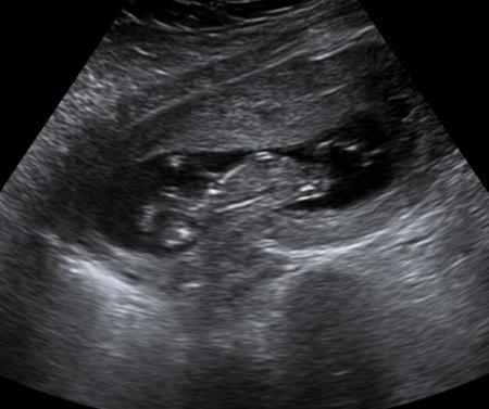 Bild zu Bildchen - Forum für Oktober - Mamis