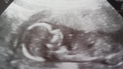 Bild zu bilderrunde : -) - Forum für Oktober - Mamis
