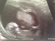 Bild zu könnt ihr das geschlecht erkennen? - Forum für Oktober - Mamis