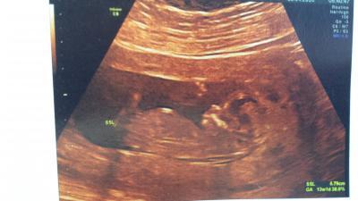 Bild zu kleines Update - Forum für Oktober - Mamis