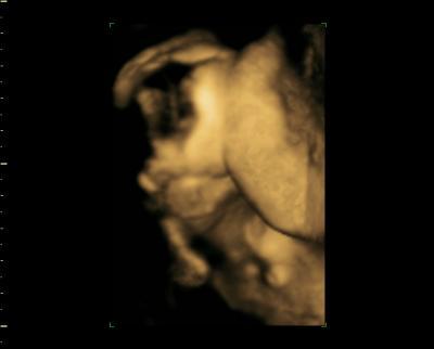 Bild zu Bilder - Forum für Oktober - Mamis