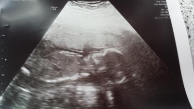 Bild zu gestern fa termin - Forum für Oktober - Mamis