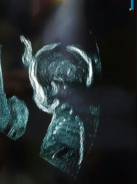 Bild zu Aktuelles US Bild - Forum für Oktober - Mamis