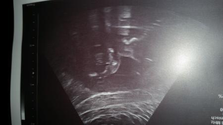 Bild zu zurück vom Gyn... - Forum für Oktober - Mamis