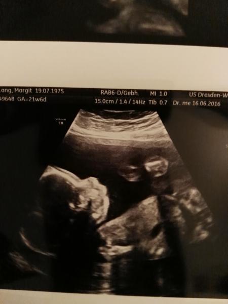 Bild zu Feindiagnostik inkl. Outing :) - Forum für Oktober - Mamis