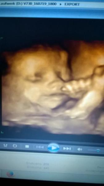 Bild zu 3D- Ultraschall - Forum für Oktober - Mamis