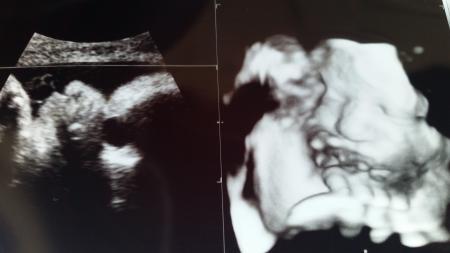Bild zu Neue Größe + Gewicht nach FA - Forum für Oktober - Mamis