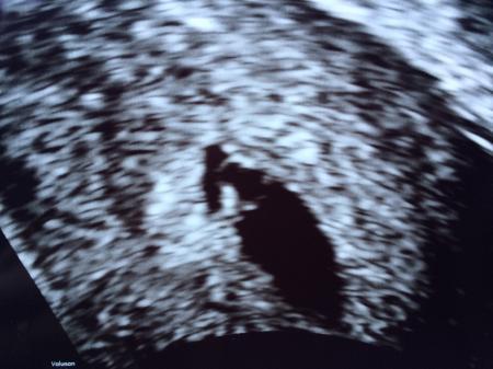 Bild zu Zurück vom FA - Forum für Oktober - Mamis
