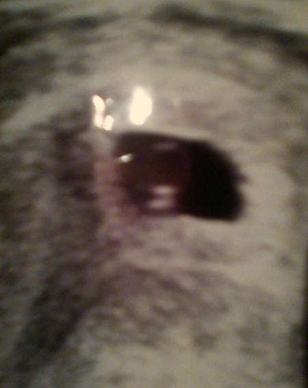 Bild zu 
