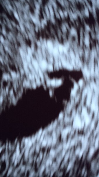 Bild zu 