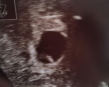 Bild zu Endlich etwas Erleichterung.., - Forum für Oktober - Mamis