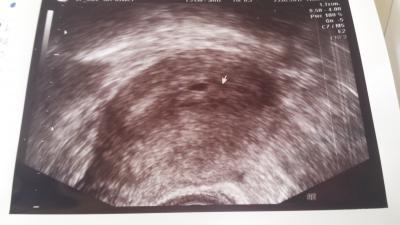 Bild zu Eure Meinung ist gefragt ☺ - Forum für Oktober - Mamis