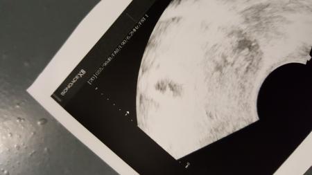 Bild zu Brauche Rat:( - Forum für Oktober - Mamis