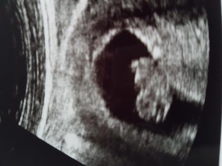 Bild zu Wochenwechsel und FA Termin. - Forum für Oktober - Mamis
