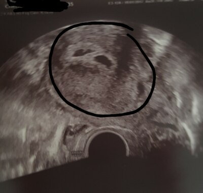 Bild zu auch zurück vom FA - Forum für Oktober - Mamis