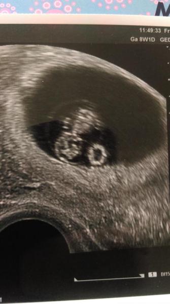 Bild zu Mutterpass - Forum für Oktober - Mamis
