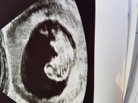 Bild zu Termin war super - Forum für Oktober - Mamis