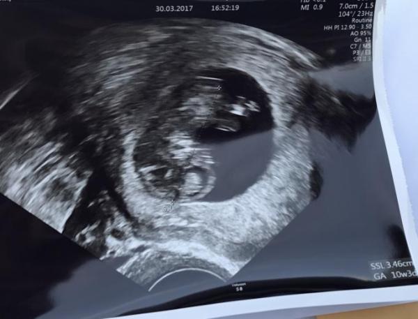 Bild zu Möchte meine Freude gerne teilen - Forum für Oktober - Mamis
