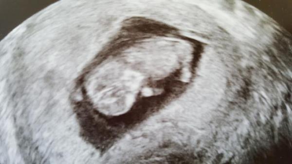 Bild zu Zurück vom FA - Forum für Oktober - Mamis