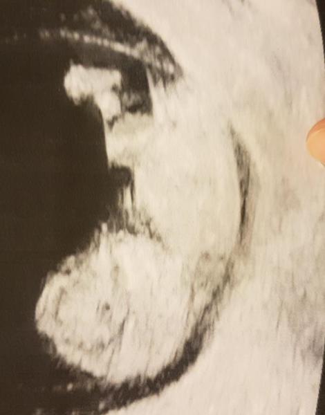 Bild zu Erste große Untersuchung - Forum für Oktober - Mamis