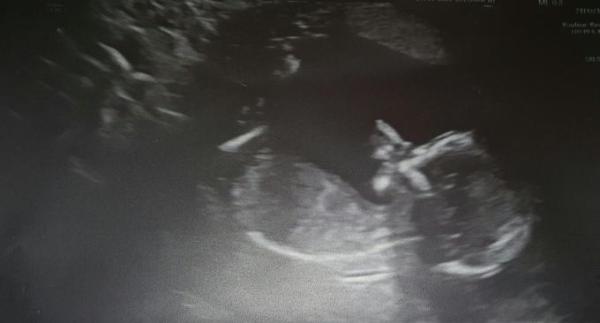 Bild zu Neu hier :) - Forum für Oktober - Mamis